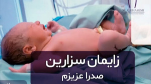زایمان سزارین صدرا عزیزم