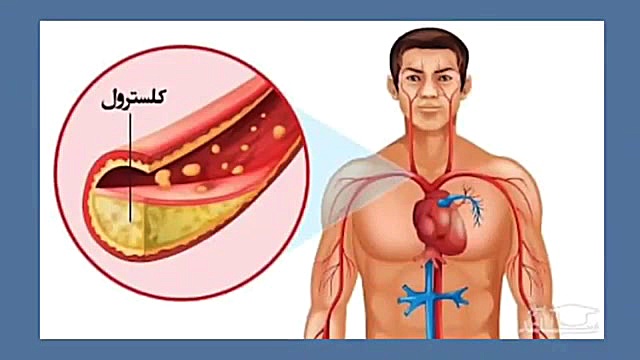 طرز تهیه جوانه گندم و پودر جوا...