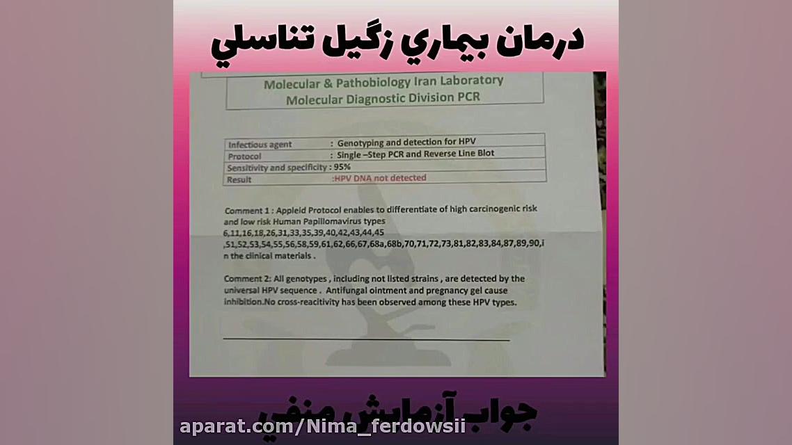 نمونه درمان های زگیل تناسلی زی...