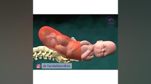 فیلم واقعی و بدون سانسور زایما...