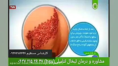 آیا تبخال تناسلی hsv درمان دار...