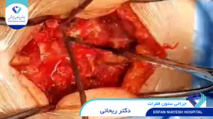 دکتر احمدرضا ریحانی یساولی  عم...