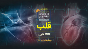 قلب (MRI قلبی)