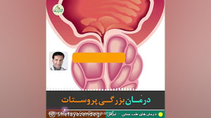 درمان بزرگی پروستات
