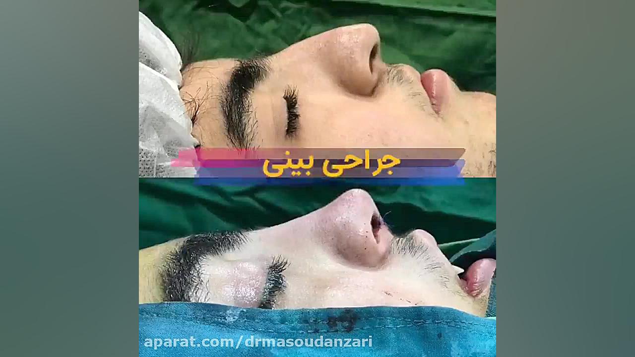 فیلم کامل و بدون سانسور از اتا...