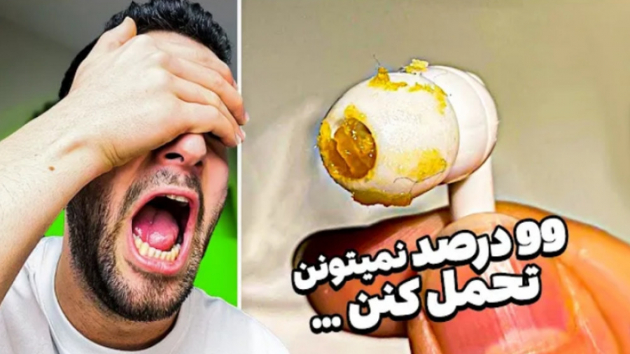 اگه میتونی عصبی نشو | 99 درصد...