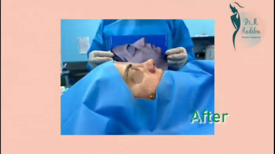 فیلم واقعی و بدون سانسور از ات...