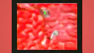 تعیین جنسیت جنین از سوی مرد ،...