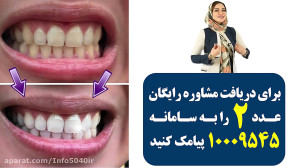 میخوای دندونت بدون جرم گیری سف...