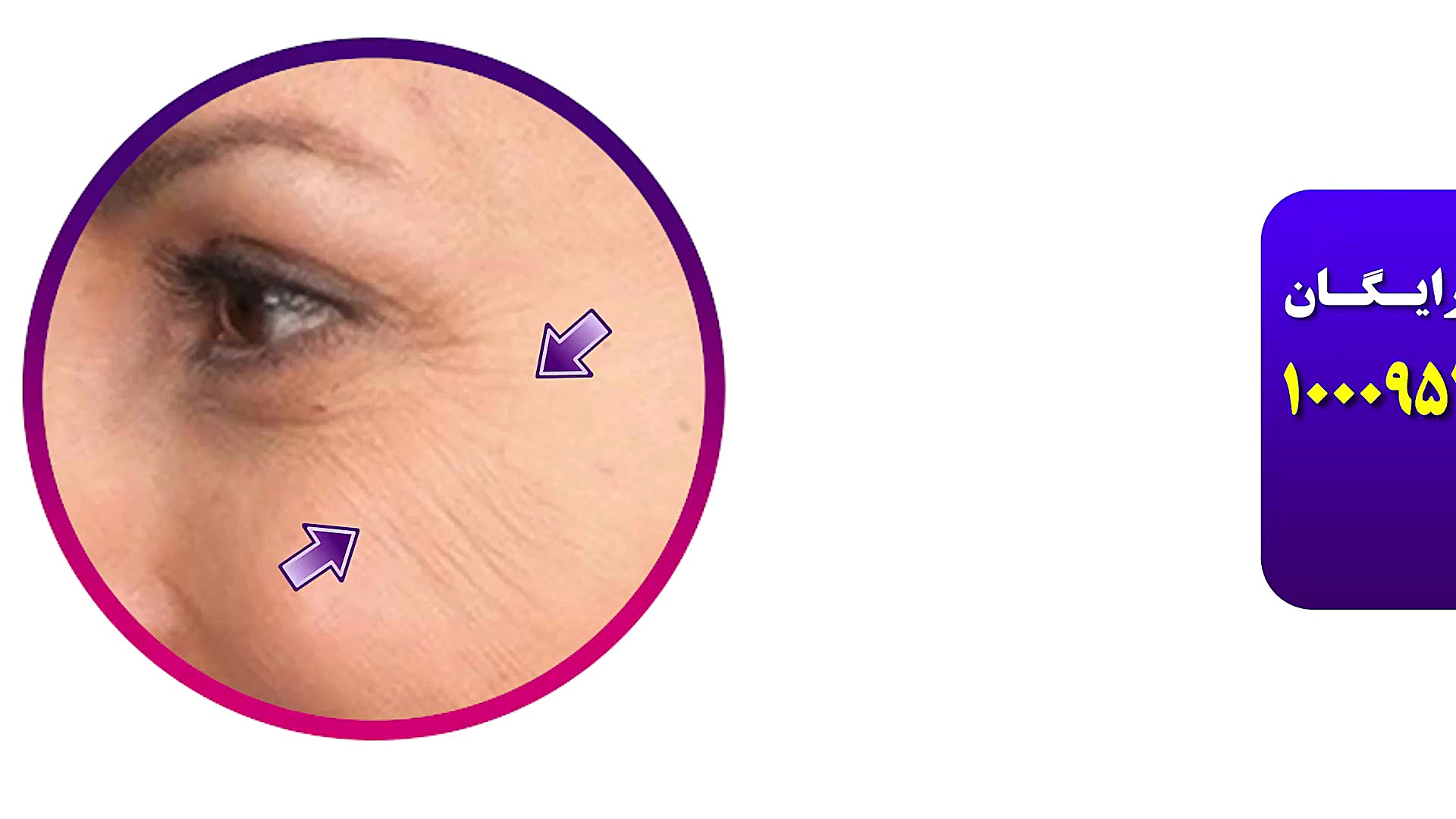 رفع چروک اطراف چشم فقط با یک م...
