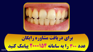 رفع تیرگی دندان با یک روش گیاه...