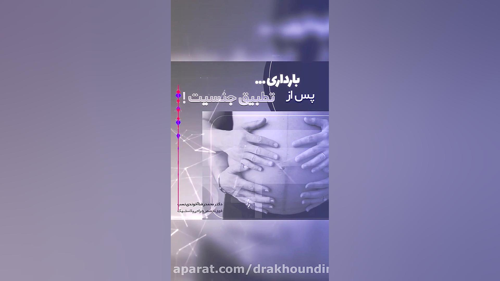 بارداری پس از تغییر جنسیت