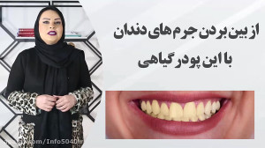 از بین بردن جرم دندان با این پ...