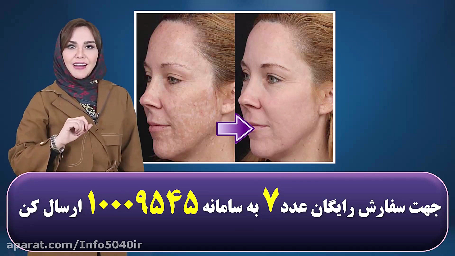 میدونی لک های صورت از کجا میاد...