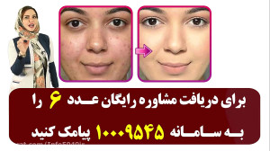 میکاپ کامل صورت با این کرم شگف...