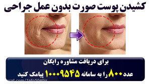 کشیدن پوست صورت بدون عمل جراحی