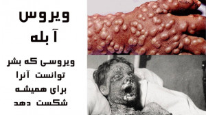 ویروس آبله: ویروسی که بشر موفق...