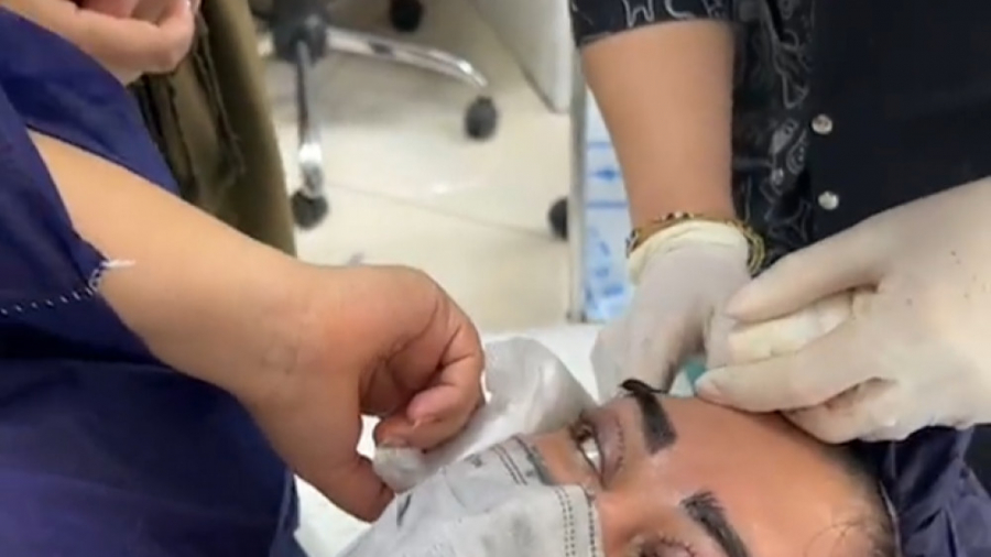 فیلم کامل چگونگی انجام کاشت اب...