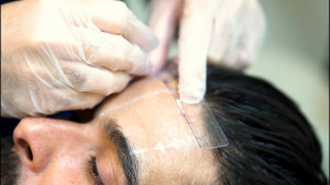 تزریق بوتاکس در کلینیک نوین ای...