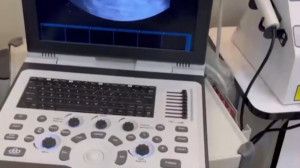 بارداری پس از ١٤ سال با يك لول...