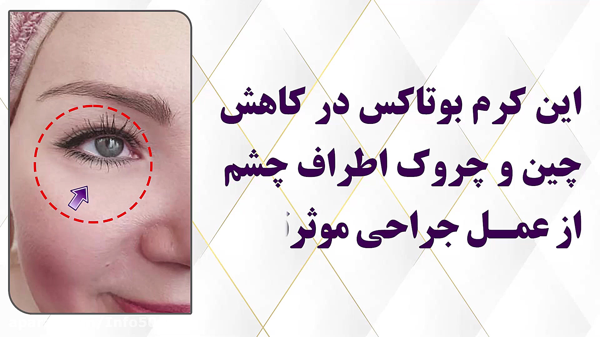 این کرم بوتاکس در کاهش چین و چ...