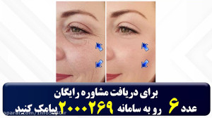 درمان چروک های صورت با این کرم...