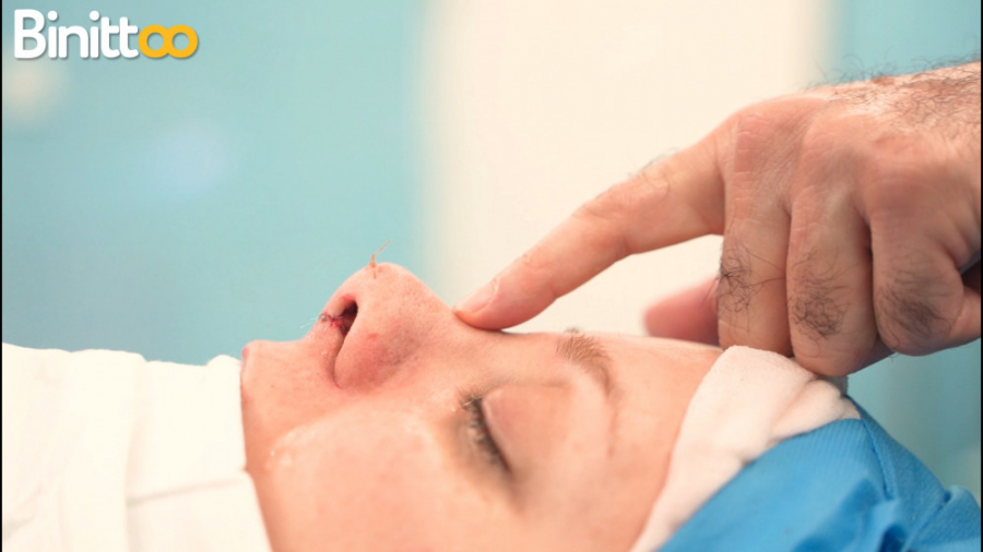 عمل بینی  دکتر جواد یزدانی