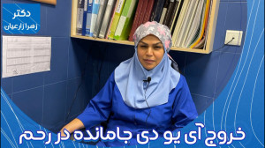 خروج آی یو دی جامانده در رحم