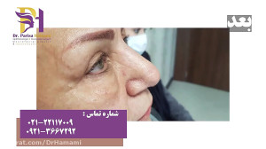فیلم واقعی و بدون سانسور جراحی...