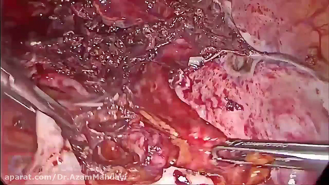 فیلم واقعی و بدون سانسور خارج...