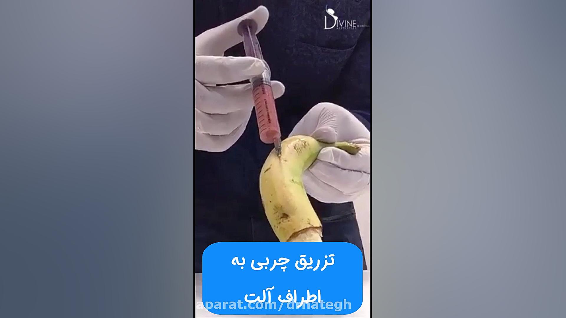 افزایش قطر آلت تناسلی بدون جرا...