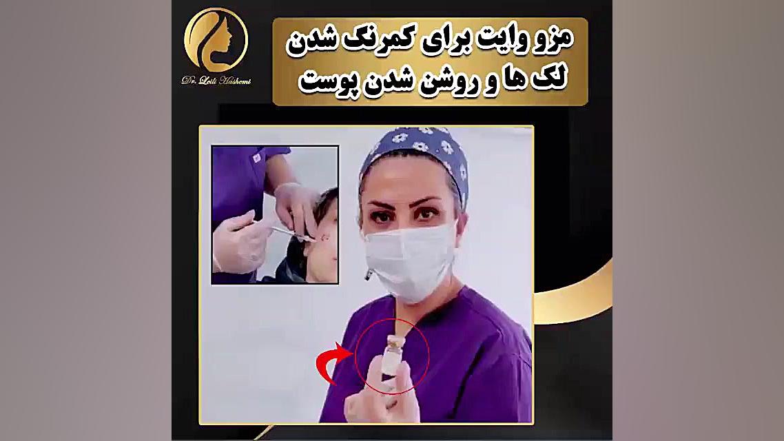 مزوتراپی وایت برای روشن وکمرنگ...