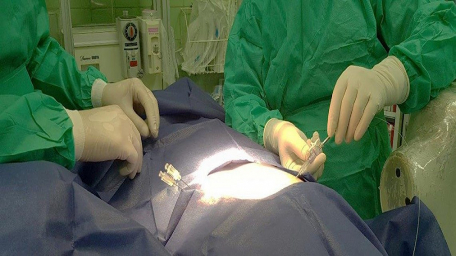 فیلم واقعی جراحی سنگ کلیه با ل...