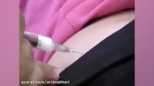 آموزش تصویری مهارت و تکنیک آمپ...