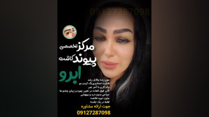 کاشت ابرو طبیعی