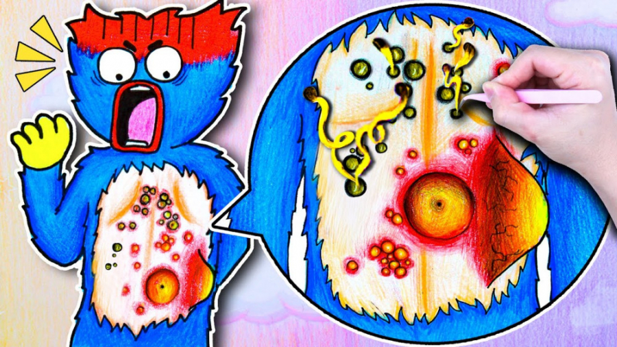 ایده کارتونی هاگی واگی  درمان...