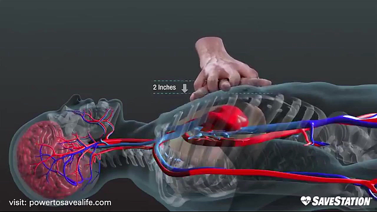 انیمیشن ماساژ قلبی :: مکانسیم...