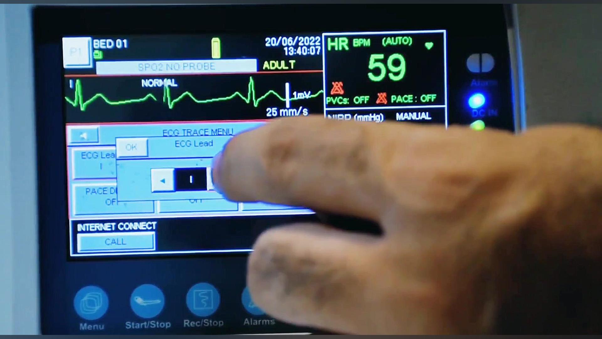 آموزش دستگاه تله کاردیولوژی SA...