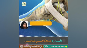 علت درد صبحگاهی مفاصل