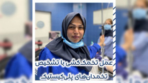 عمل تخمک کشی با تشخیص تخمدانها...