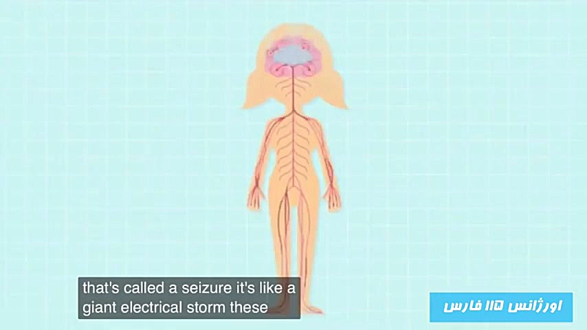 دانستنی های بیماری صرع