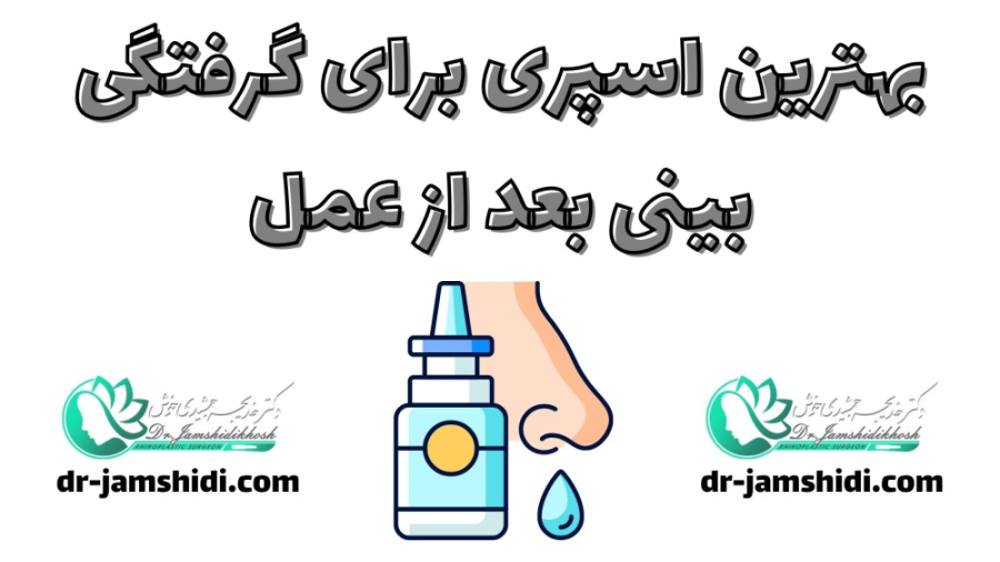 بهترین اسپری برای گرفتگی بینی...