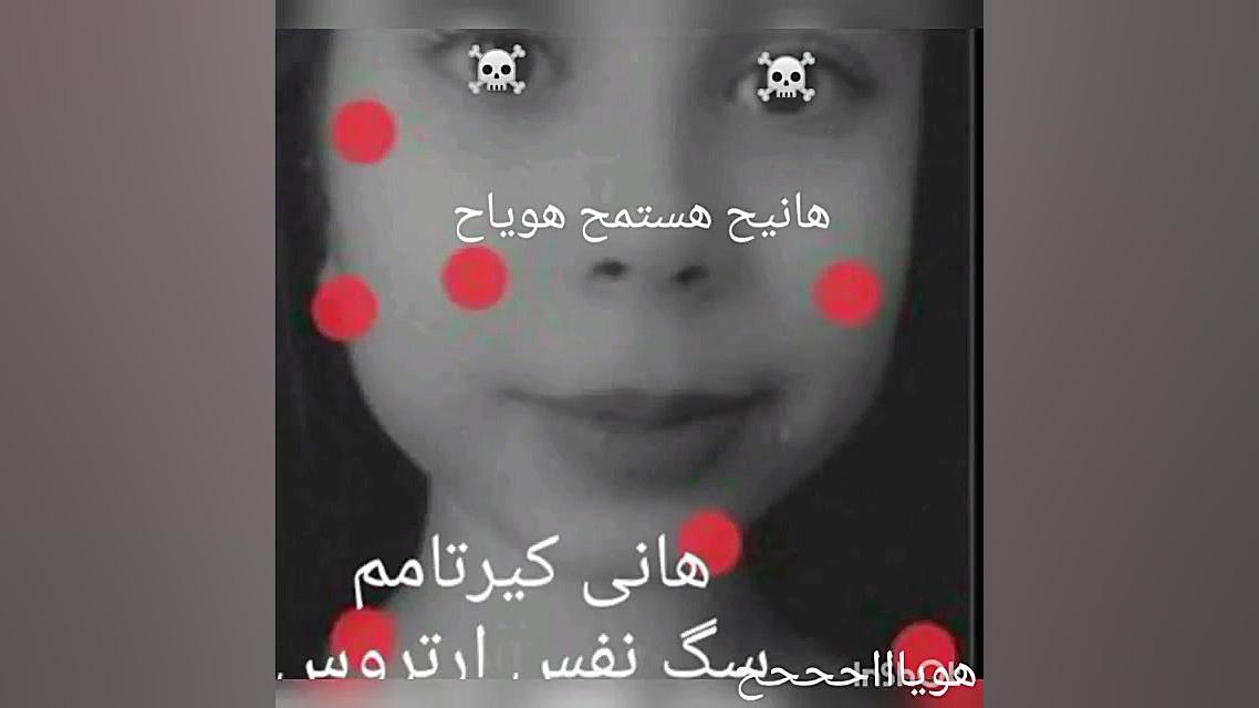 هانی سکسچتر