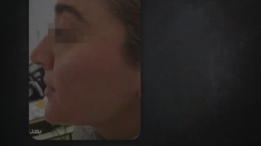 زاویه سازی فک دکتر ماندانا رها...