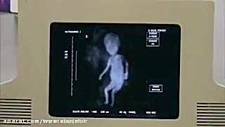 لحظه خنده دار به دنیا آمدن یک...