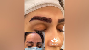 کاشت ابروی هوژین