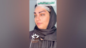 کاشت ابروی کلینیک هوژین
