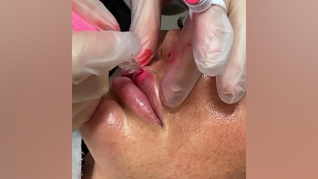 فیکانتور لب تکنیک رژلب دائم