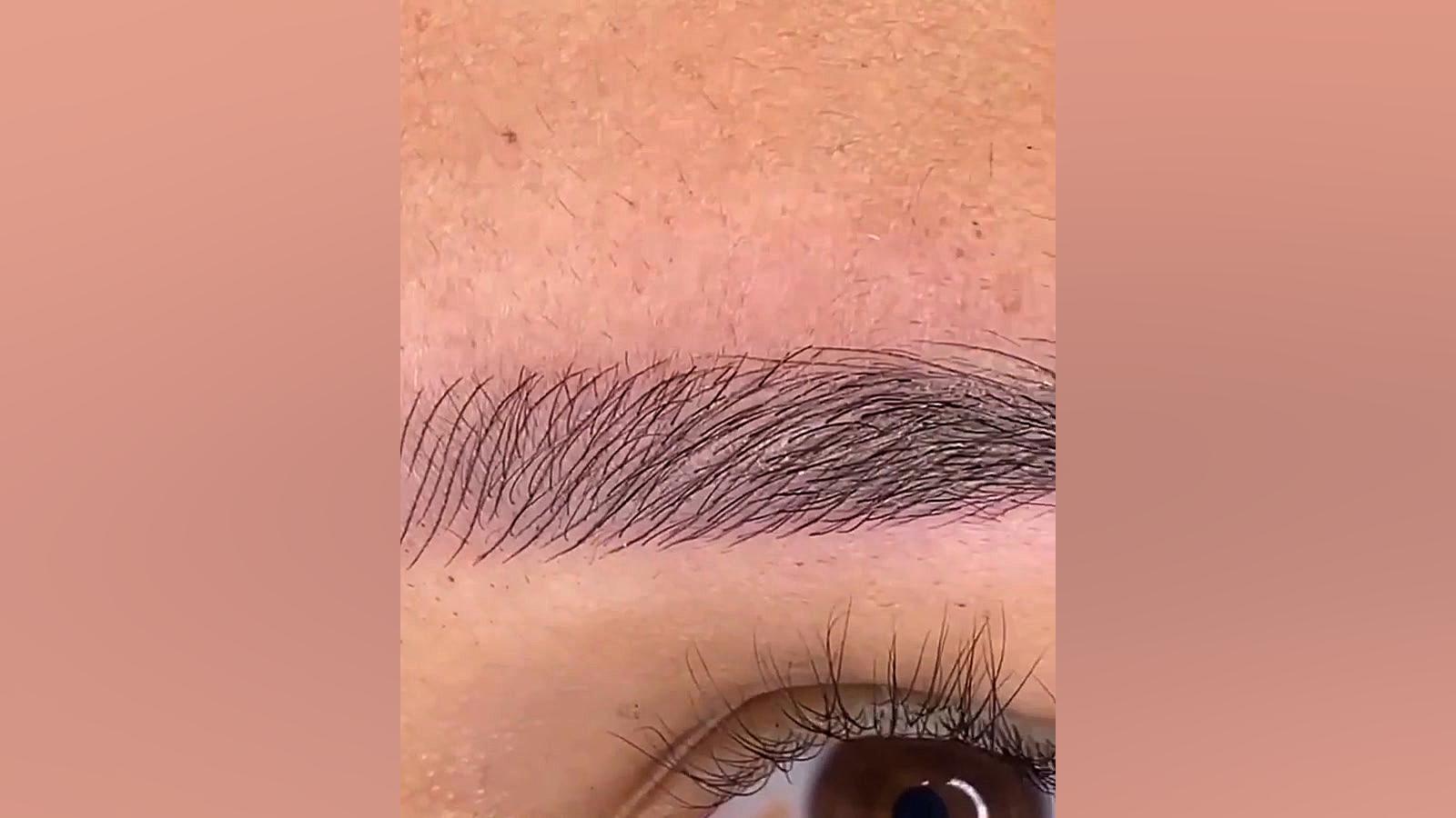 فیبروز ابرو تکنیک میکروبلیدینگ