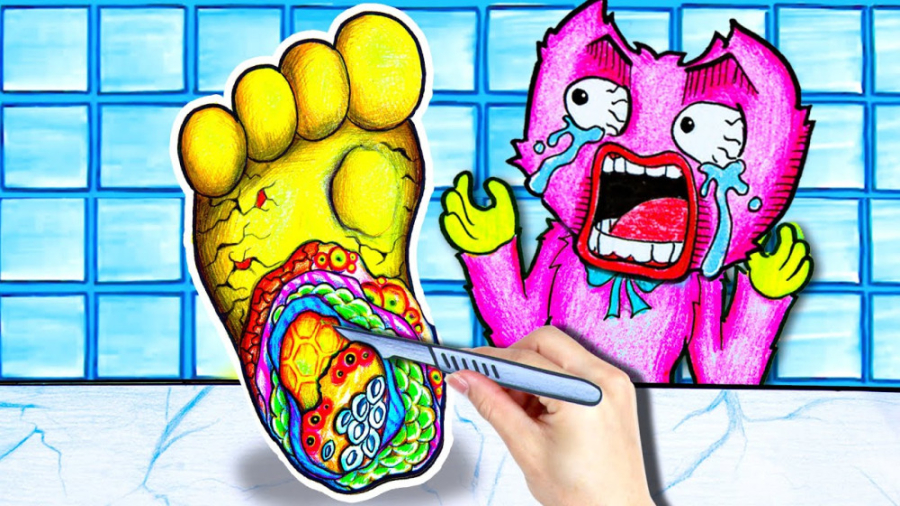 ایده کارتونی کیسی میسی  درمان...